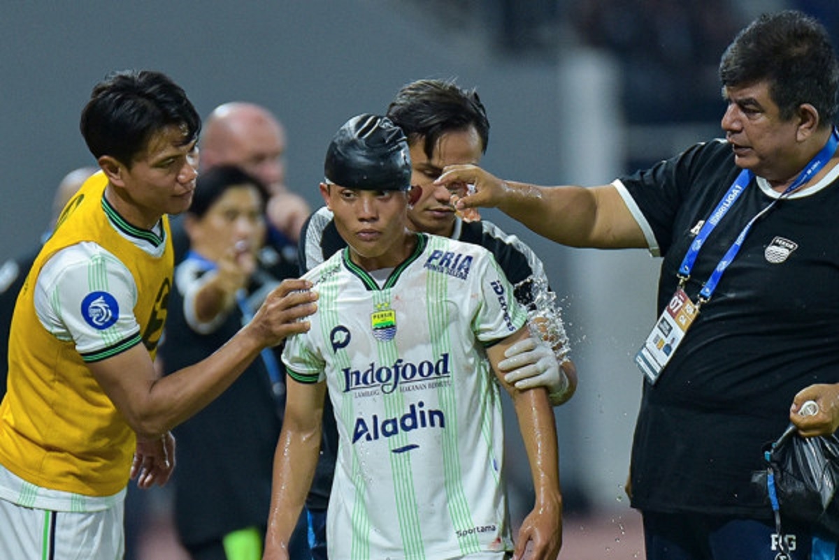 Update Kondisi Striker Persib Bandung Usai Diterjang Kiper PSIS, Sempat Mengaku Pusing Kepala
