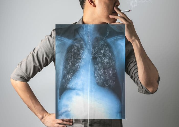 Bahaya Merokok dan Pencegahannya Terutama di Kalangan Remaja