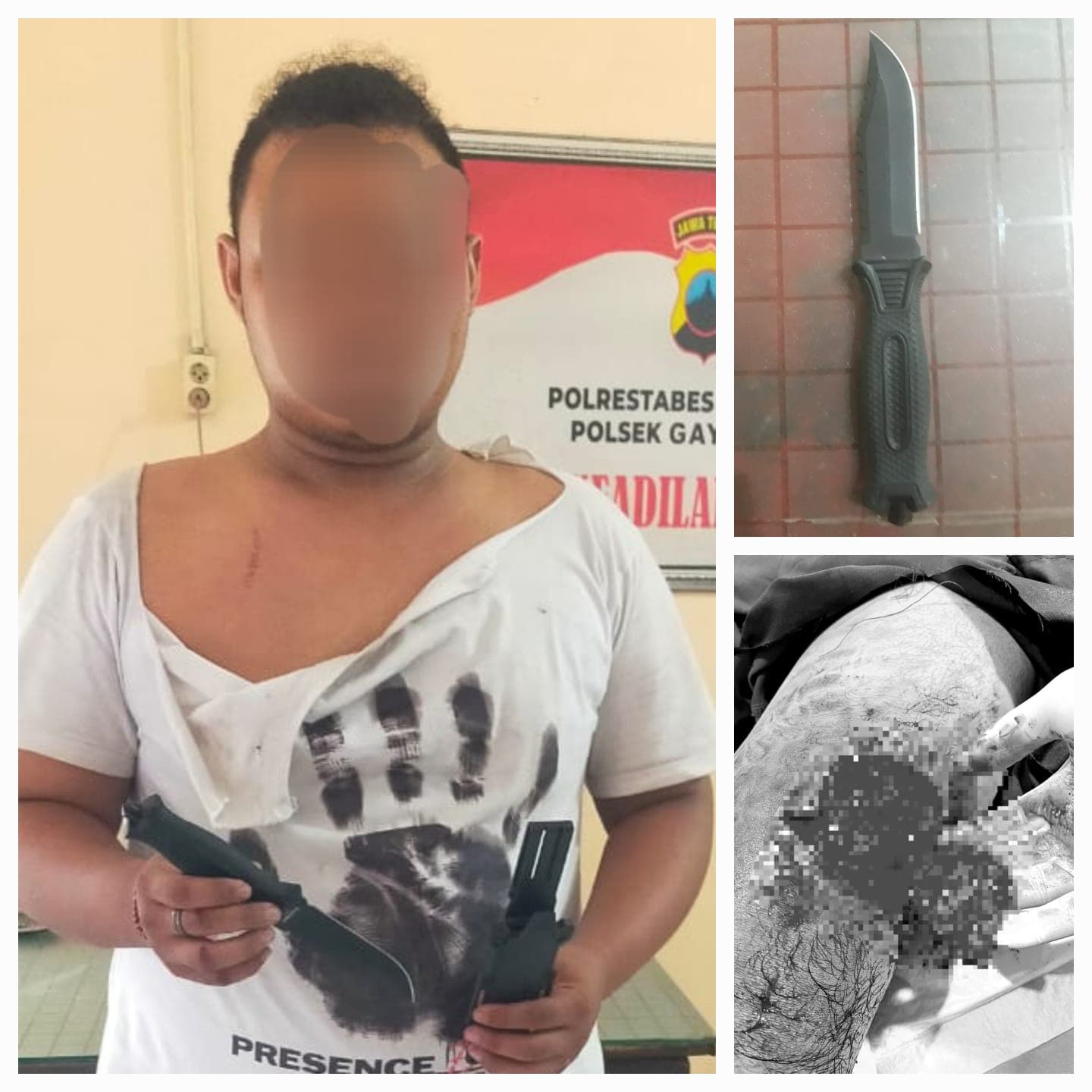 Remaja di Semarang Luka Kena Sajam Saat Coba Lerai Keributan di Depan Kafe