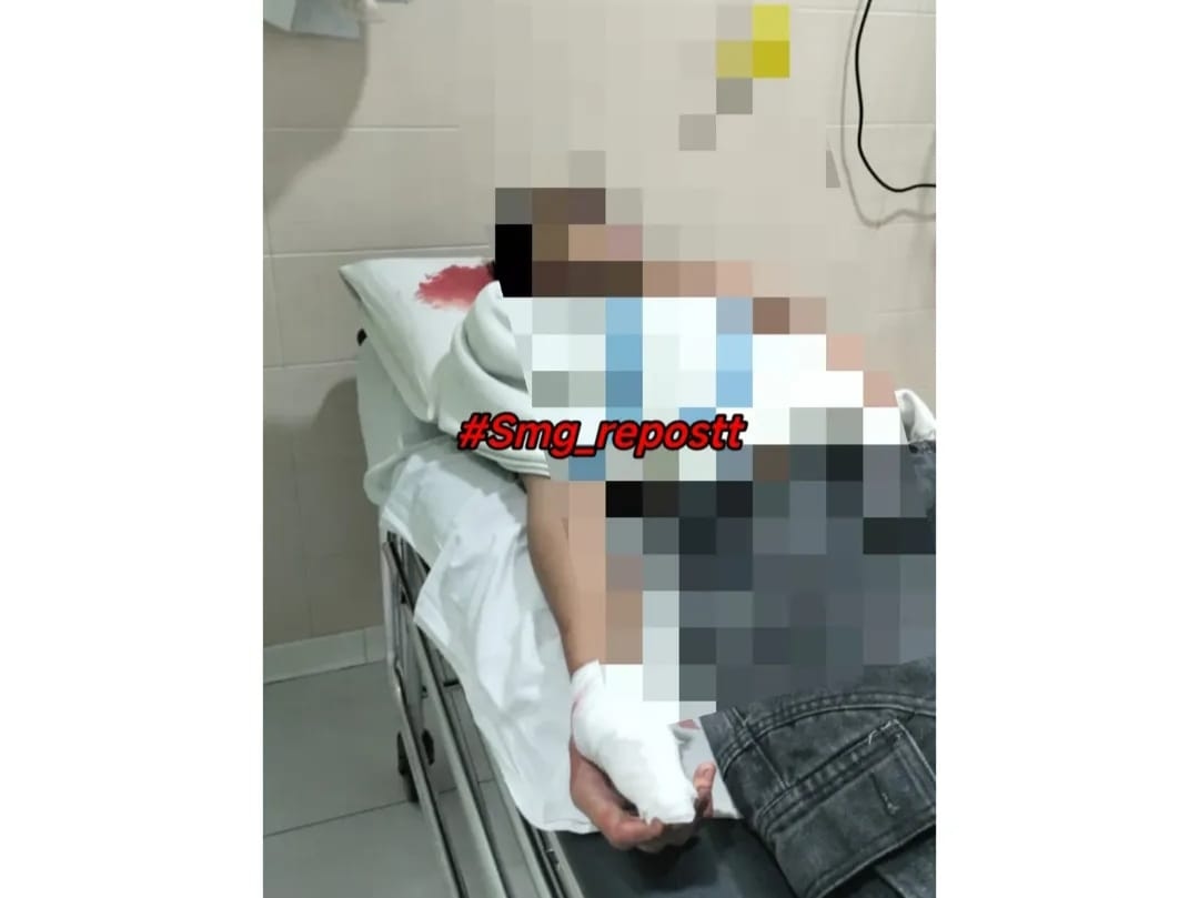 Pemuda di Semarang Dibac*k OTK Saat Membeli Rokok di Warung Barutikung